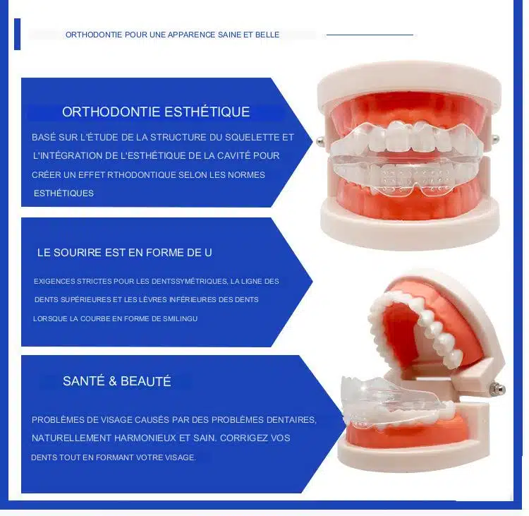 Gouttière de réalignement dentaire en 3 étapes