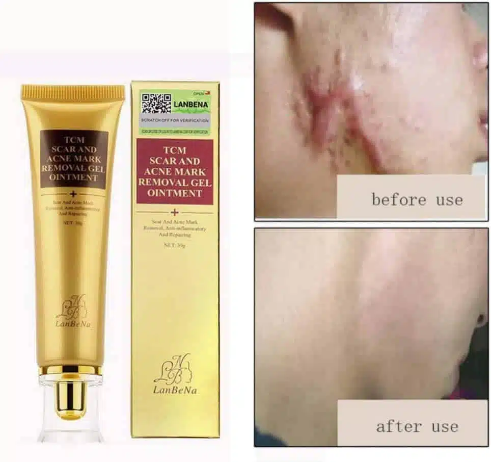 Crema antiescaras