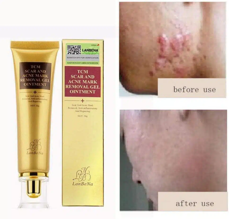 Crema antiescaras