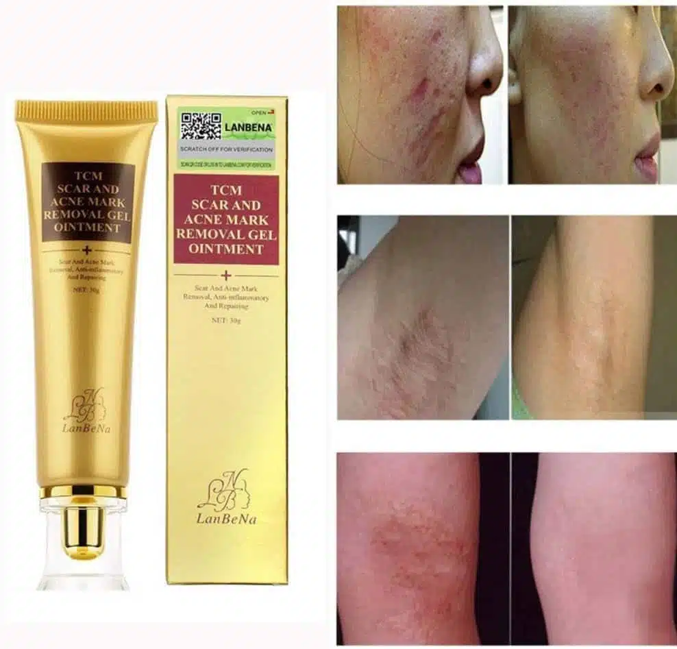 Crema antiescaras