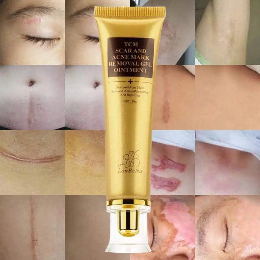 Crema antiescaras