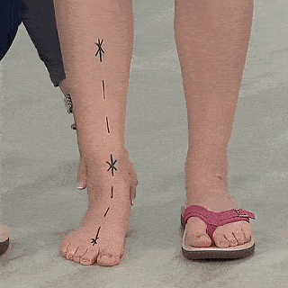 Sandales orthopédiques d'été pour femmes