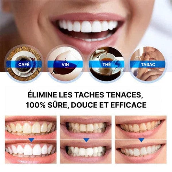 Stylo Blanchisseur de Dents - White Teeth