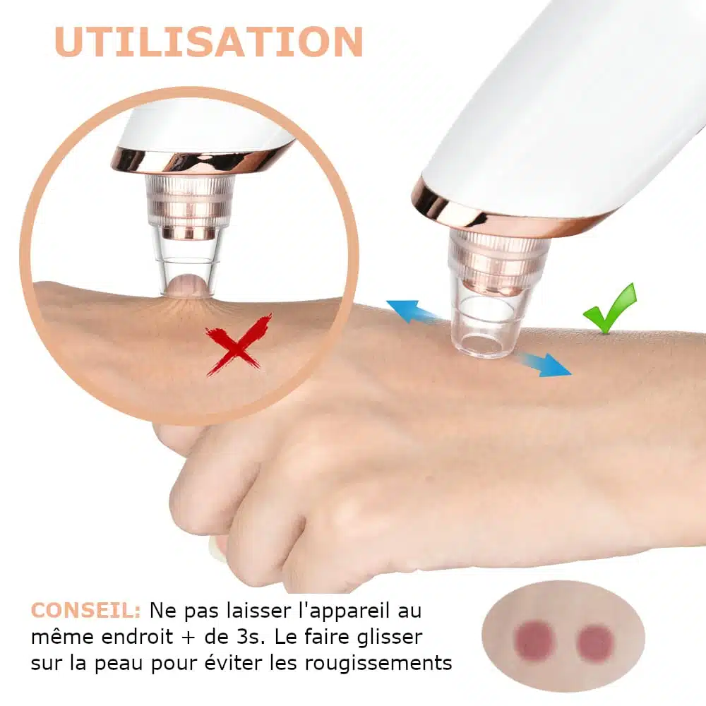 Aspirateur à Points Noirs | Nettoyeur de pores FaceCare