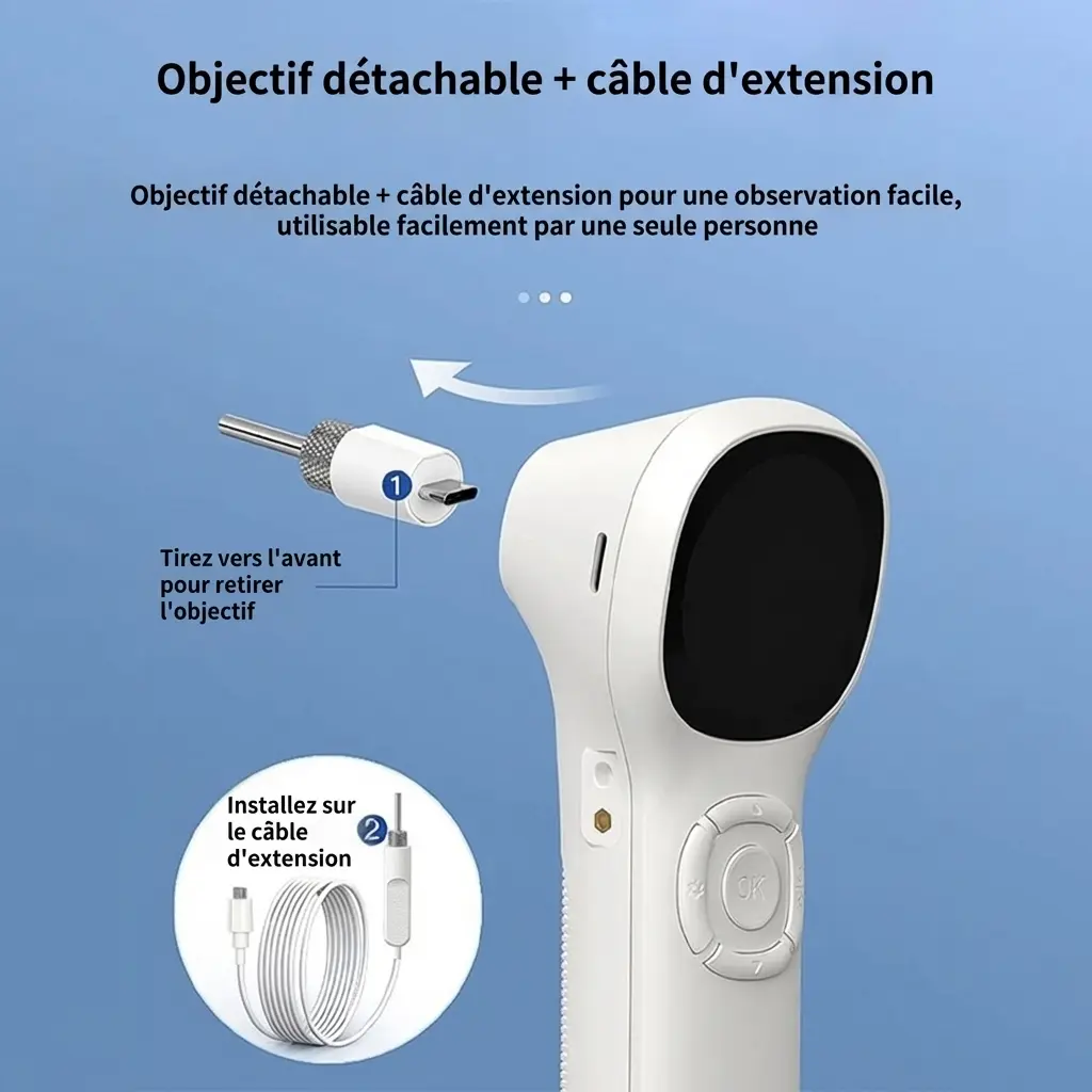Otoscope numérique intelligent ecran IPS caméra HD