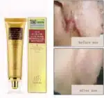 Crema Regeneradora Antiescaras - Imagen 6