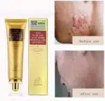 Crema Regeneradora Antiescaras - Imagen 7