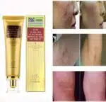 Crema Regeneradora Antiescaras - Imagen 10