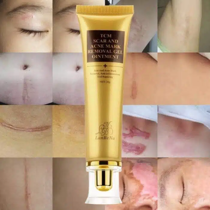Crème anti-cicatrices