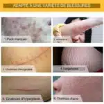 Crema Regeneradora Antiescaras - Imagen 8