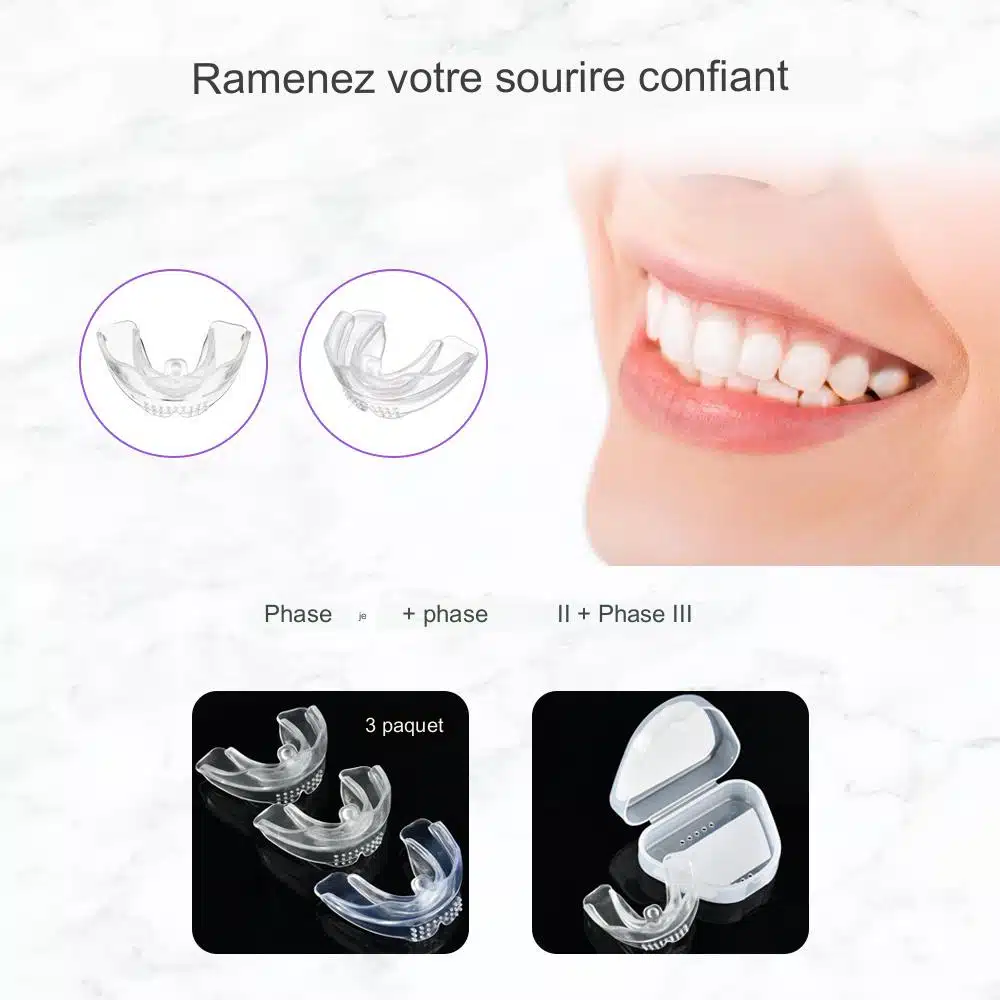 Gouttière de réalignement dentaire en 3 étapes