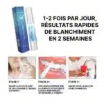 Stylo Blanchisseur de Dents - White Teeth – Image 19