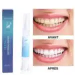 Stylo Blancheur Dent – HealthCare™ 8