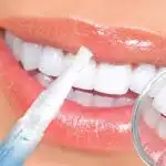 Stylo Blancheur Dent – HealthCare™ 3