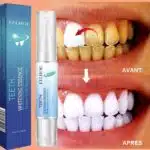 Stylo Blancheur Dent – HealthCare™ 2