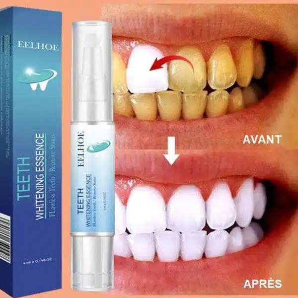 Stylo Blancheur Dent – HealthCare™ 2
