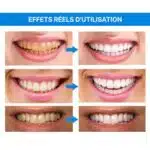 Stylo Blancheur Dent – HealthCare™ 17