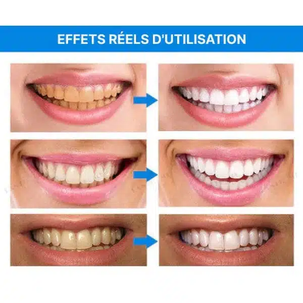 Stylo Blancheur Dent – HealthCare™ 17