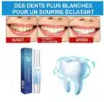 Stylo Blanchisseur de Dents - White Teeth