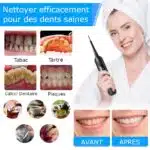Kit de détartrage et soins dentaire électrique ToothCare – Image 4