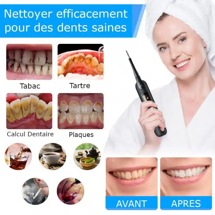 Kit de détartrage et soins dentaire électrique ToothCare – Image 4