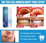 Stylo Blanchisseur de Dents - White Teeth