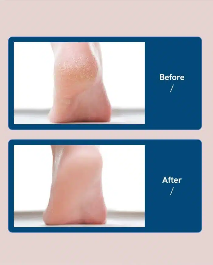 Kit de Pédicure Professionnel FootCare