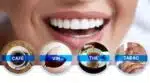 Stylo Blanchisseur de Dents - White Teeth – Image 9