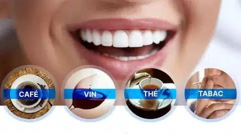 Stylo Blanchisseur de Dents - White Teeth – Image 9