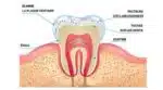 Stylo Blanchisseur de Dents - White Teeth – Image 11
