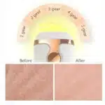 Epilateur Laser à lumière pulsée pour Femmes – Image 19