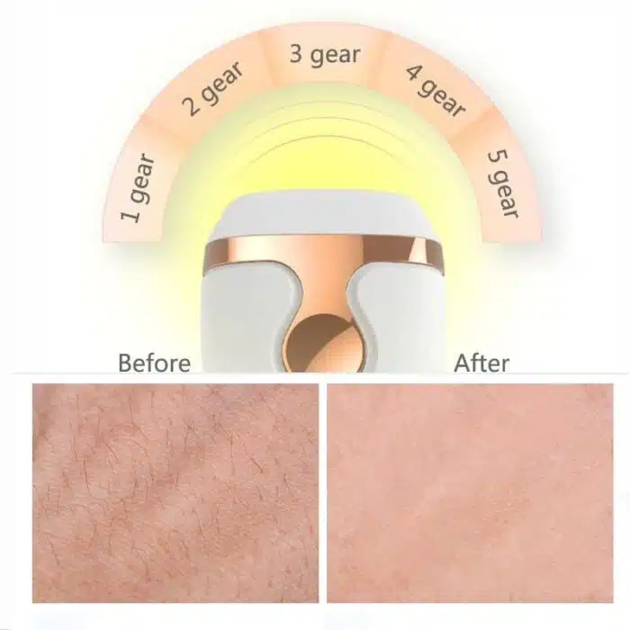 Epilateur Laser à lumière pulsée pour Femmes – Image 19