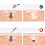 Aspirateur à Points Noirs | Nettoyeur de pores FaceCare – Image 3