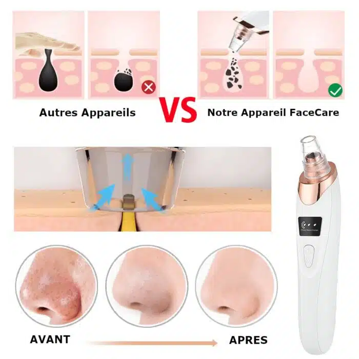 Aspirateur à Points Noirs | Nettoyeur de pores FaceCare – Image 9