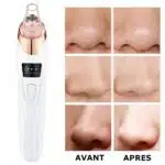 Aspirateur à Points Noirs | Nettoyeur de pores FaceCare – Image 7