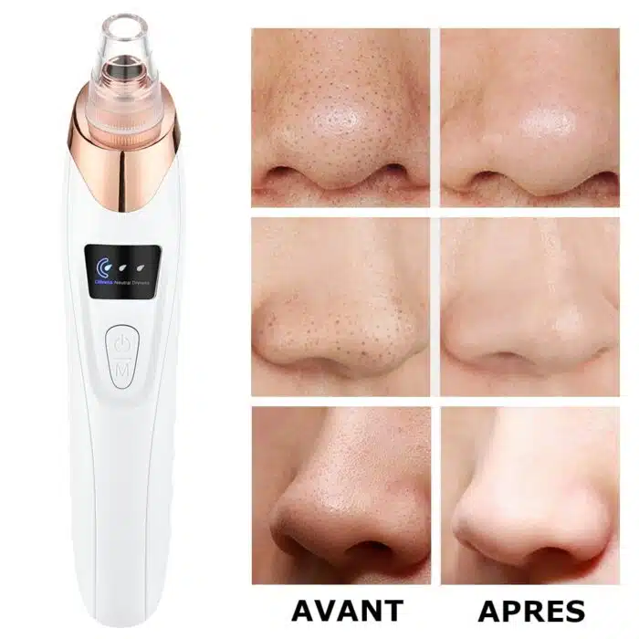 Aspirateur à Points Noirs | Nettoyeur de pores FaceCare – Image 7
