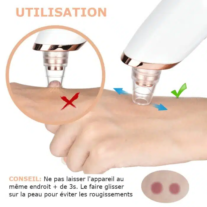Aspirateur à Points Noirs | Nettoyeur de pores FaceCare – Image 16