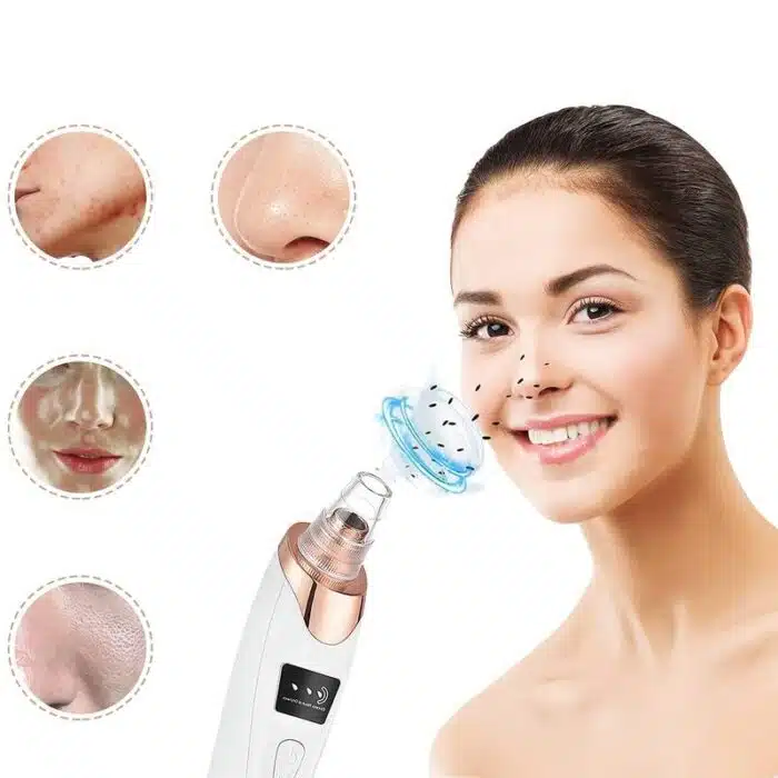 Aspirateur à Points Noirs | Nettoyeur de pores FaceCare – Image 10