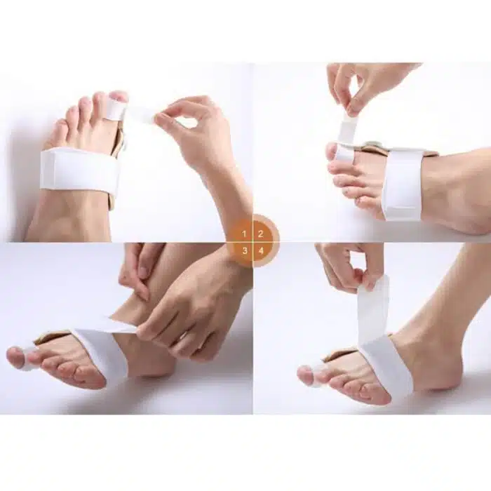 Correcteur Hallux Valgus Efficace | Orthèse – Image 13