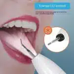 Raspador dental ultrasónico con cámara - Imagen 23