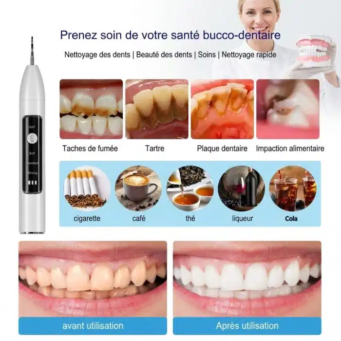 Détartreur dentaire à Ultrasons avec caméra – Image 11
