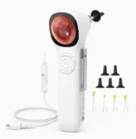 Otoscope numérique intelligent ecran IPS caméra HD