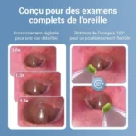 Otoscope numérique intelligent ecran IPS caméra HD