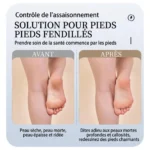 Kit de pédicure professionnel soins des pieds rechargeable USB