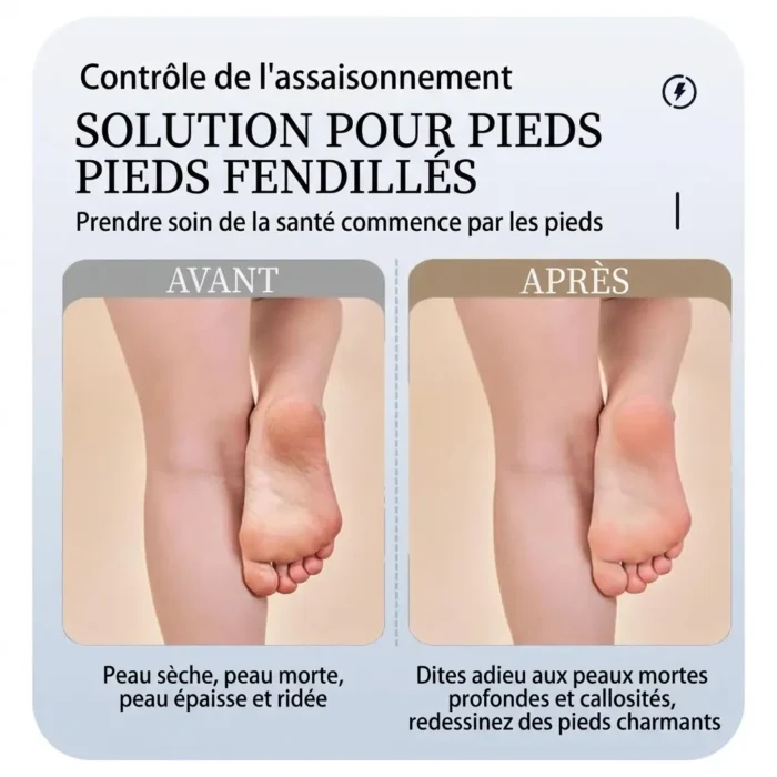 Kit de pédicure professionnel soins des pieds rechargeable USB