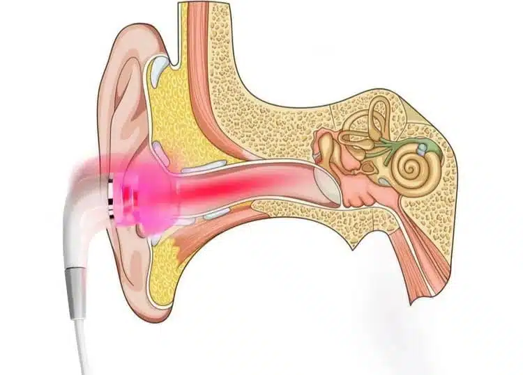Appareil Anti-Acouphènes HealthCare™