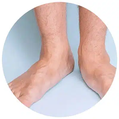 Chaussures Orthopédiques De Marche Femme