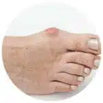 Chaussures Orthopédiques De Marche Femme