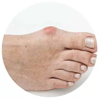 Chaussures Orthopédiques De Marche Femme